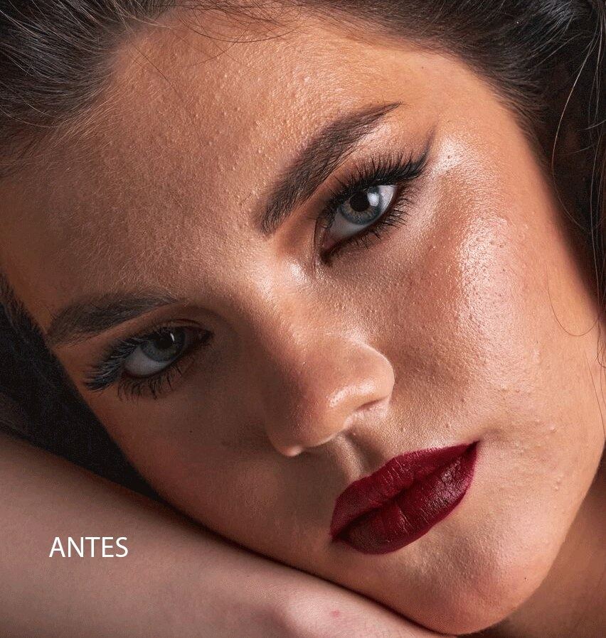 Tratamento facial, antes